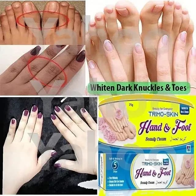 Kojic Extract Cream for Hands, Feet, Elbows, and Neck - Suitable for All Skin Types