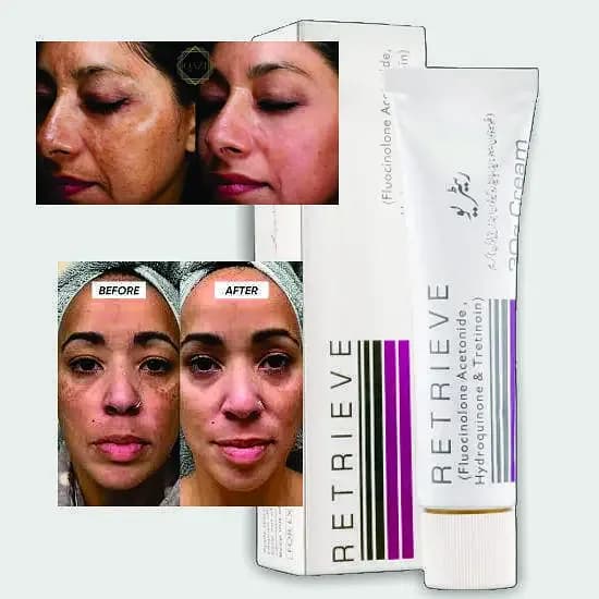 ReTrieve Tretinoin Cream for Clearer and Brighter Skin