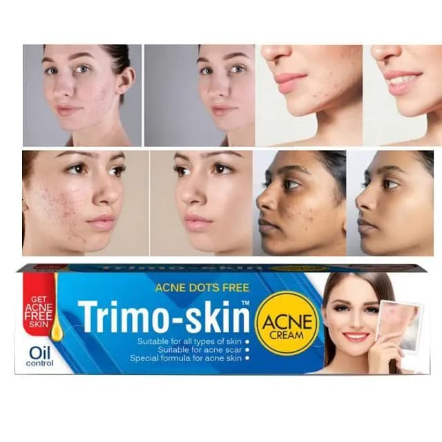 Trimo-Skin Anti Acne Cream: 6-in-1 Solution for Acne, Pore Reduction, and Scar Diminishment