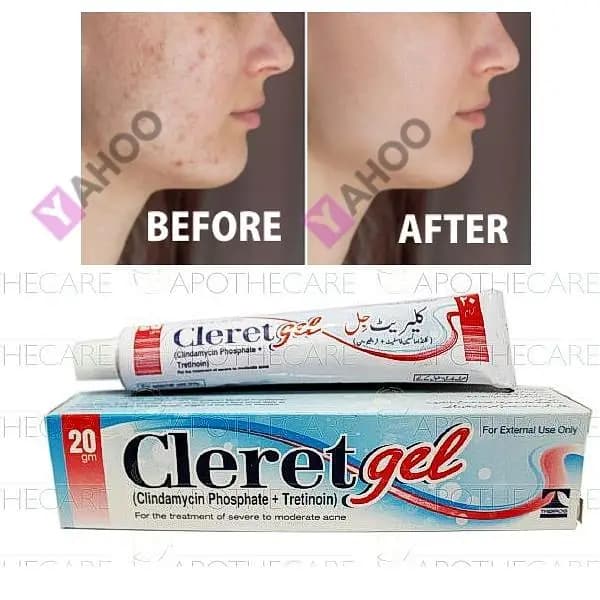 CLERET GEL (Clindamycin Phosphate 1% + Tretinoin 0.025%) 20gm - Prescription Acne Treatment with Dual Action