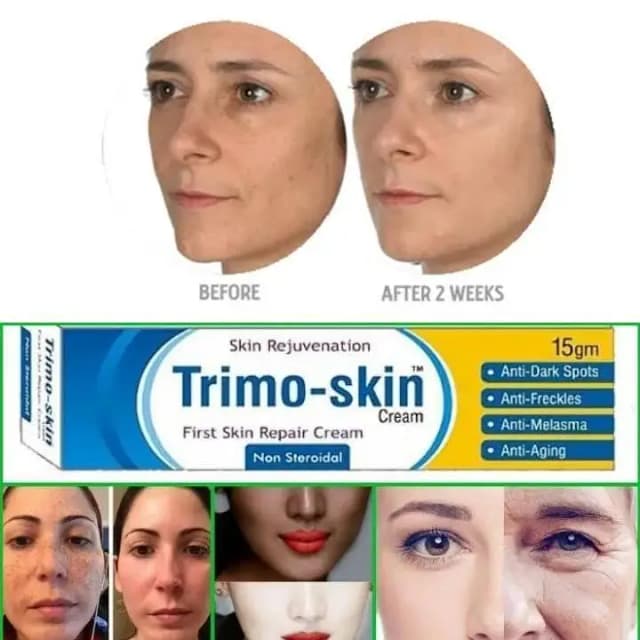 Trimo Group Montis Spot Remover Face Cream for Scar Removal and Dark Circles