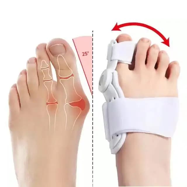 Big Bone Toe Bunion Splint Toe Straightener Corrector Foot Pain Relief Hallux Valgus Correction Orthopedic Supplies
