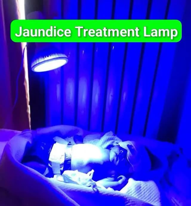jaundice treatment lamp . Phototherapy Lamp For Jaundice treatment
