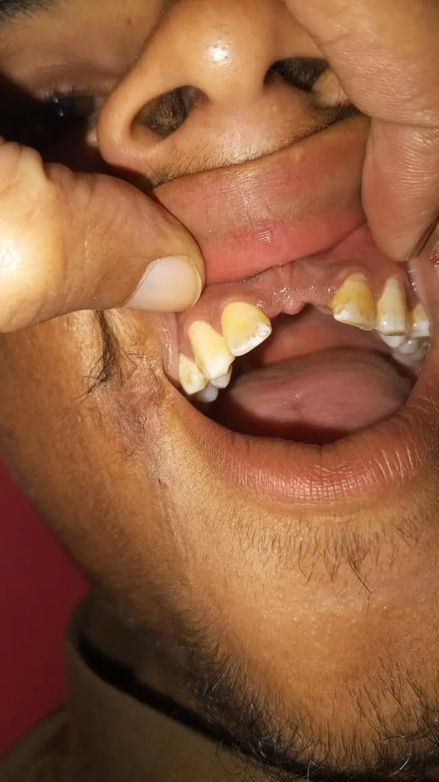Dental serjon required contact number 03061622662